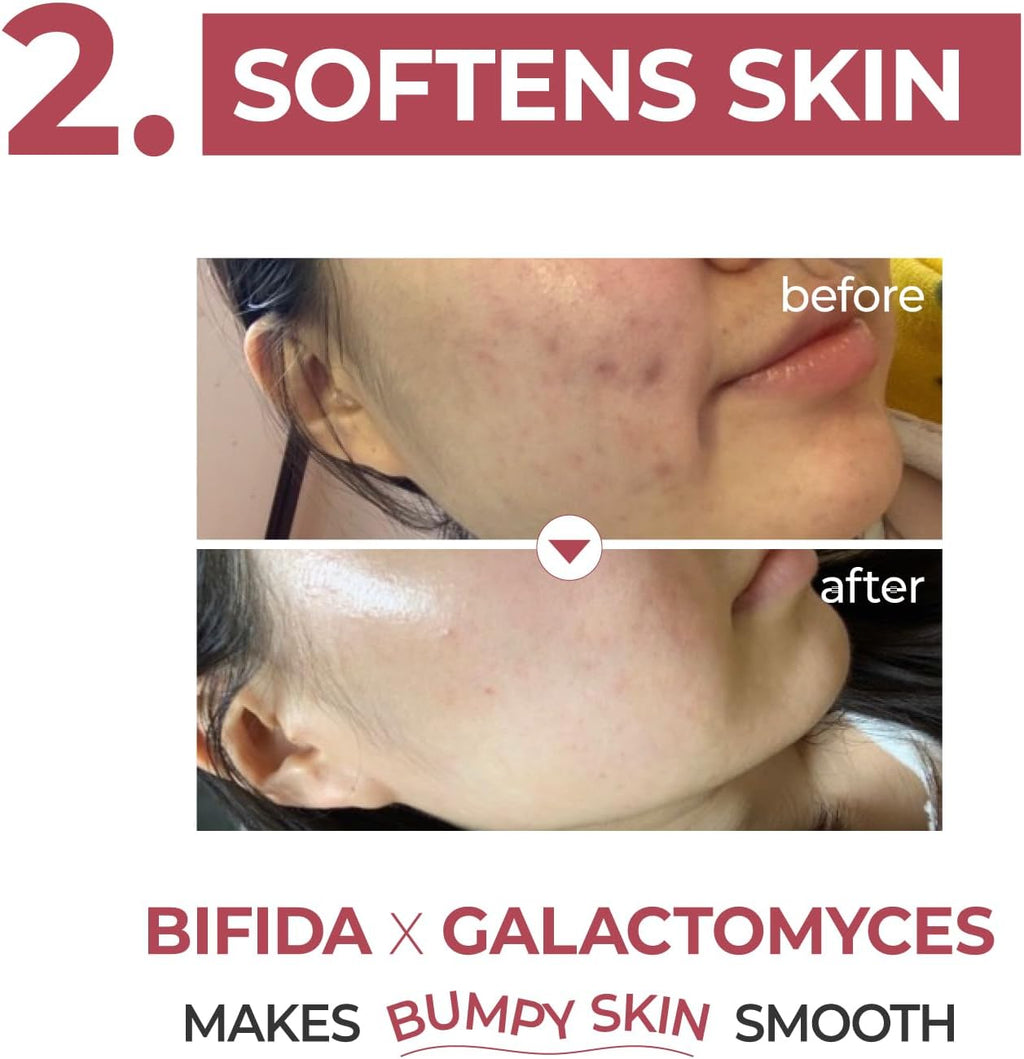 numbuzin No.3 Skin Softening Serum 50ml – Texture Smoothing Serum
