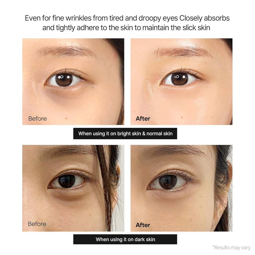 Dr. Melaxin Cemenrete Calcium Dark Spot Eye Cream 15g | Brightening & Firming Eye Care