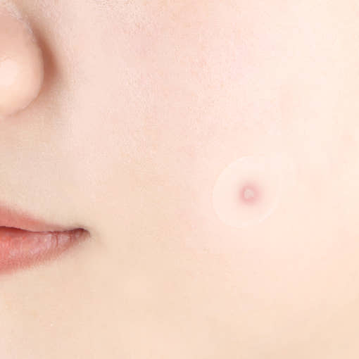 Pyunkang Yul Clear Spot Patch – 72 Patches – Korean beauty product image 4
